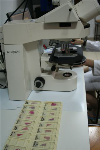 ESAV